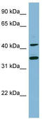 SLP-65 antibody, TA339310, Origene, Western Blot image 