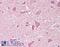 Neural Cell Adhesion Molecule 2 antibody, 45-990, ProSci, Immunohistochemistry paraffin image 
