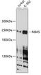Neuroblastoma Amplified Sequence antibody, A03821, Boster Biological Technology, Western Blot image 