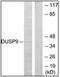 Dual Specificity Phosphatase 9 antibody, AP32268PU-N, Origene, Western Blot image 
