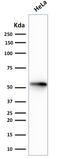 Keratin-7 antibody, AE00252, Aeonian Biotech, Western Blot image 