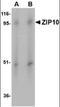 Solute Carrier Family 39 Member 10 antibody, orb88500, Biorbyt, Western Blot image 