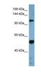 Cordon-Bleu WH2 Repeat Protein Like 1 antibody, NBP1-70505, Novus Biologicals, Western Blot image 