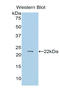 Vitamin K-dependent protein S antibody, LS-C298521, Lifespan Biosciences, Western Blot image 