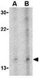 Neuritin 1 antibody, GTX85446, GeneTex, Western Blot image 