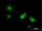 Protein VAC14 homolog antibody, H00055697-B01P, Novus Biologicals, Immunocytochemistry image 