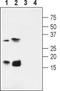 Potassium Voltage-Gated Channel Subfamily E Regulatory Subunit 4 antibody, TA328981, Origene, Western Blot image 
