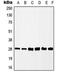 Casein kinase II subunit beta antibody, orb213792, Biorbyt, Western Blot image 