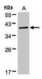 PKACA antibody, PA5-21842, Invitrogen Antibodies, Western Blot image 