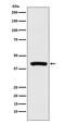 Peptidylprolyl Isomerase D antibody, M02424-2, Boster Biological Technology, Western Blot image 