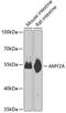 Amylase Alpha 2A (Pancreatic) antibody, 23-366, ProSci, Western Blot image 