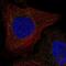 Transmembrane Protein 270 antibody, NBP2-69031, Novus Biologicals, Immunofluorescence image 