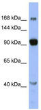 Mediator Complex Subunit 23 antibody, TA338173, Origene, Western Blot image 