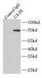 Carbonic Anhydrase 9 antibody, FNab01153, FineTest, Immunoprecipitation image 