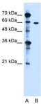 Zinc Finger DHHC-Type Containing 13 antibody, TA335278, Origene, Western Blot image 