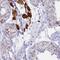 Ubiquitin Conjugating Enzyme E2 O antibody, HPA023605, Atlas Antibodies, Immunohistochemistry frozen image 