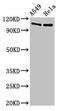 EMAP Like 4 antibody, LS-C672635, Lifespan Biosciences, Western Blot image 