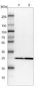 Phosphomannomutase 1 antibody, NBP1-87055, Novus Biologicals, Western Blot image 