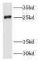 Ras-related protein Rab-35 antibody, FNab07019, FineTest, Western Blot image 