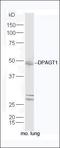 Dolichyl-Phosphate N-Acetylglucosaminephosphotransferase 1 antibody, orb183188, Biorbyt, Western Blot image 