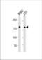 ATP-dependent RNA helicase A antibody, TA325155, Origene, Western Blot image 