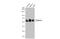 Recombining binding protein suppressor of hairless antibody, GTX112358, GeneTex, Western Blot image 