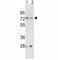 Neuroendocrine convertase 2 antibody, F50579-0.4ML, NSJ Bioreagents, Western Blot image 
