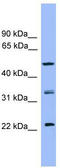 RAB8B, Member RAS Oncogene Family antibody, TA342691, Origene, Western Blot image 