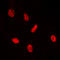 ETS2 Repressor Factor antibody, abx133147, Abbexa, Western Blot image 