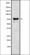 Receptor-interacting serine/threonine-protein kinase 1 antibody, orb337122, Biorbyt, Western Blot image 