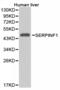 Serpin Family F Member 1 antibody, LS-C192859, Lifespan Biosciences, Western Blot image 