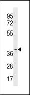 Leucine Rich Repeat Containing 74B antibody, PA5-49148, Invitrogen Antibodies, Western Blot image 
