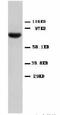 Signal Transducer And Activator Of Transcription 1 antibody, LS-C171700, Lifespan Biosciences, Western Blot image 