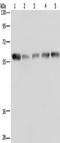 Nuclear pore glycoprotein p62 antibody, TA350241, Origene, Western Blot image 