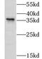 LysM Domain Containing 3 antibody, FNab04909, FineTest, Western Blot image 