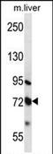 Matrix metalloproteinase-17 antibody, PA5-71871, Invitrogen Antibodies, Western Blot image 