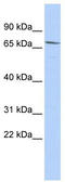 Maternal Embryonic Leucine Zipper Kinase antibody, TA339317, Origene, Western Blot image 