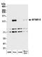 FANCD2 And FANCI Associated Nuclease 1 antibody, A302-660A, Bethyl Labs, Western Blot image 