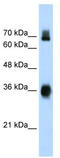 Cytosolic inhibitor of Nrf2 antibody, TA337702, Origene, Western Blot image 