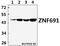 Zinc Finger Protein 691 antibody, A15569-1, Boster Biological Technology, Western Blot image 