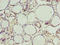 Nucleolar Protein 4 Like antibody, LS-C397319, Lifespan Biosciences, Immunohistochemistry paraffin image 