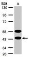 Calcium-binding and spermatid-specific protein 1 antibody, NBP1-31573, Novus Biologicals, Western Blot image 