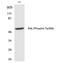 SH2 domain-containing adapter protein B antibody, PA5-40212, Invitrogen Antibodies, Western Blot image 