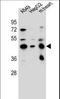 Leucine Rich Repeat Containing 28 antibody, LS-C165875, Lifespan Biosciences, Western Blot image 