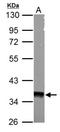 Protein Kinase AMP-Activated Non-Catalytic Subunit Gamma 1 antibody, NBP2-15382, Novus Biologicals, Western Blot image 