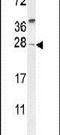 TIMP Metallopeptidase Inhibitor 4 antibody, PA5-23657, Invitrogen Antibodies, Western Blot image 