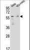 Forkhead box protein N1 antibody, LS-C166234, Lifespan Biosciences, Western Blot image 