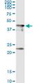 CPAP antibody, MA5-22212, Invitrogen Antibodies, Immunoprecipitation image 