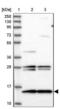 Ubiquinol-Cytochrome C Reductase Complex Assembly Factor 2 antibody, NBP2-14240, Novus Biologicals, Western Blot image 
