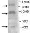 ADAM Metallopeptidase With Thrombospondin Type 1 Motif 2 antibody, TA310092, Origene, Western Blot image 